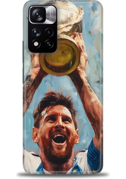 Xiaomi Redmi Note 11 Pro Plus Hd Baskılı Kılıf + Seramik Tam Kaplayan Ekran Koruyucu 14