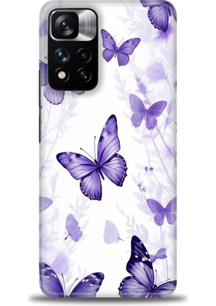 Xiaomi Redmi Note 11 Pro Plus Hd Baskılı Kılıf + Seramik Tam Kaplayan Ekran Koruyucu 293
