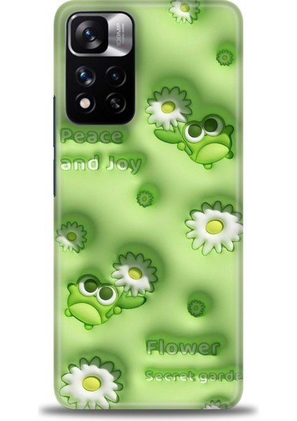 Xiaomi Redmi Note 11 Pro Plus Hd Baskılı Kılıf + Seramik Tam Kaplayan Ekran Koruyucu 116