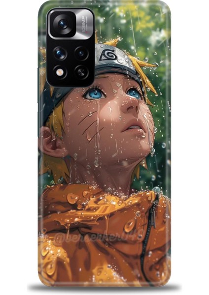 Xiaomi Redmi Note 11 Pro Plus Hd Baskılı Kılıf + Seramik Tam Kaplayan Ekran Koruyucu 257