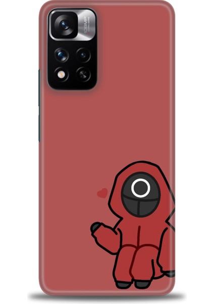 Xiaomi Redmi Note 11 Pro Plus Hd Baskılı Kılıf + Seramik Tam Kaplayan Ekran Koruyucu 288