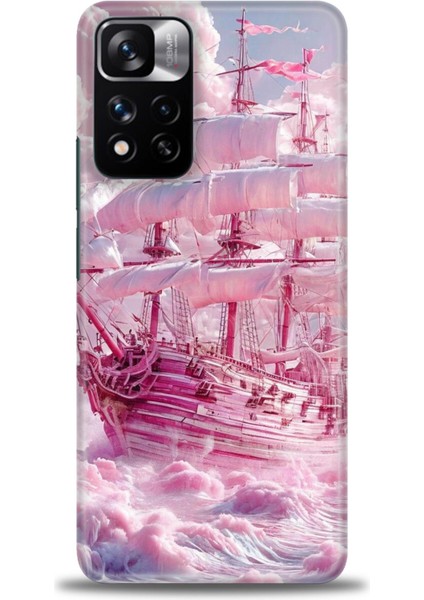 Xiaomi Redmi Note 11 Pro Plus Hd Baskılı Kılıf + Seramik Tam Kaplayan Ekran Koruyucu 238