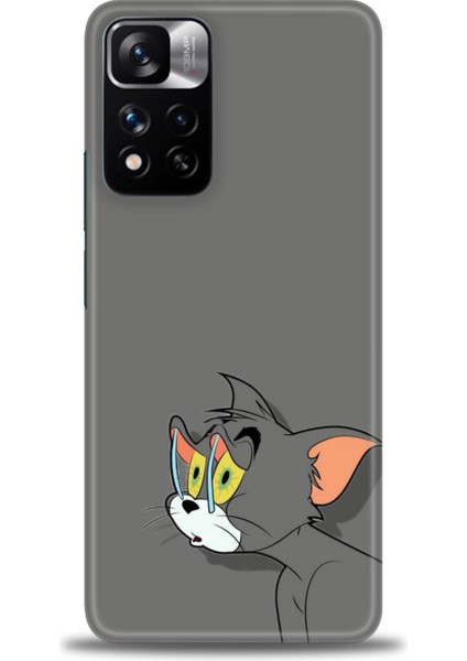 Xiaomi Redmi Note 11 Pro Plus Hd Baskılı Kılıf + Seramik Tam Kaplayan Ekran Koruyucu 408