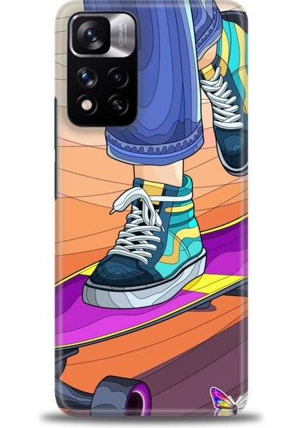 Xiaomi Redmi Note 11 Pro Plus Hd Baskılı Kılıf + Seramik Tam Kaplayan Ekran Koruyucu 446