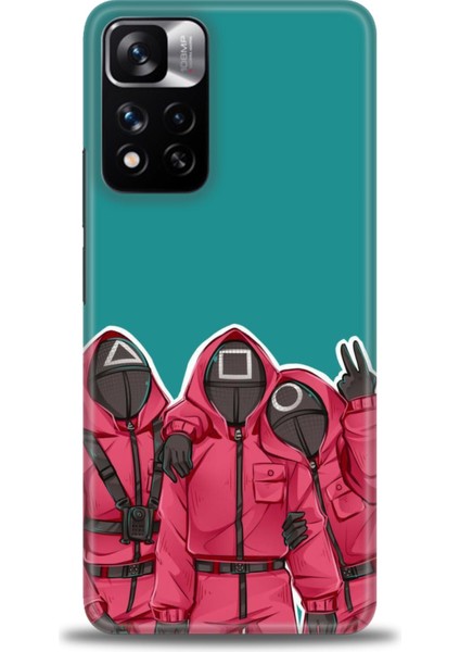 Xiaomi Redmi Note 11 Pro Plus Hd Baskılı Kılıf + Seramik Tam Kaplayan Ekran Koruyucu 290