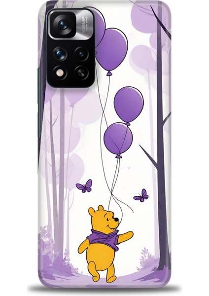 Xiaomi Redmi Note 11 Pro Plus Hd Baskılı Kılıf + Seramik Tam Kaplayan Ekran Koruyucu 51