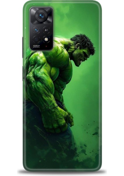 Xiaomi Redmi Note 11 Pro 4g Hd Baskılı Kılıf + Seramik Tam Kaplayan Ekran Koruyucu 96