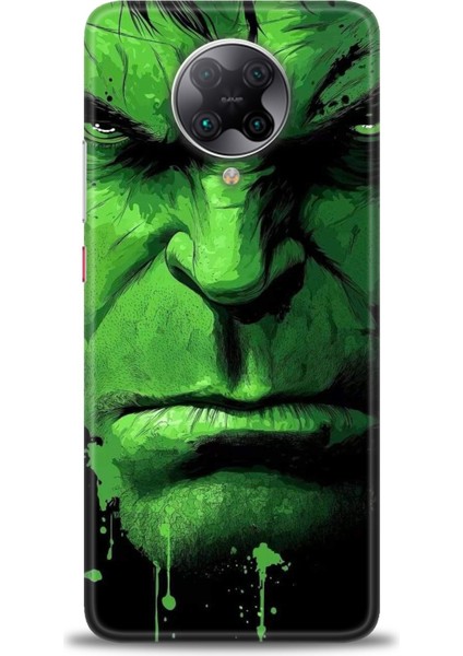 Xiaomi Redmi K30 Pro Hd Baskılı Kılıf + Seramik Tam Kaplayan Ekran Koruyucu 94