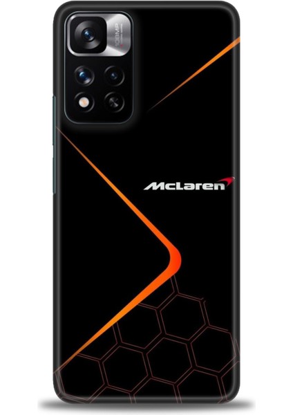 Xiaomi Redmi Note 11 Pro Plus Hd Baskılı Kılıf + Seramik Tam Kaplayan Ekran Koruyucu 379