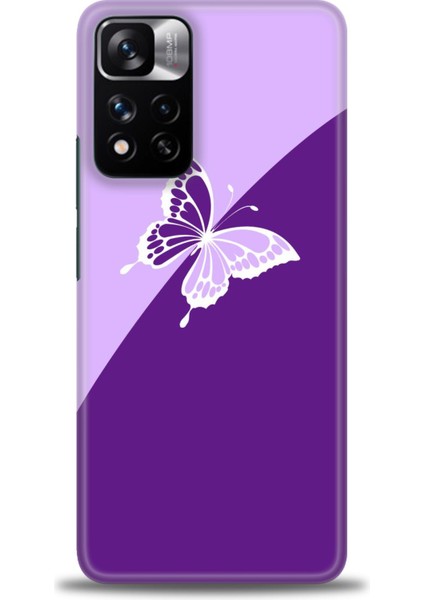 Xiaomi Redmi Note 11 Pro Plus Hd Baskılı Kılıf + Seramik Tam Kaplayan Ekran Koruyucu 297