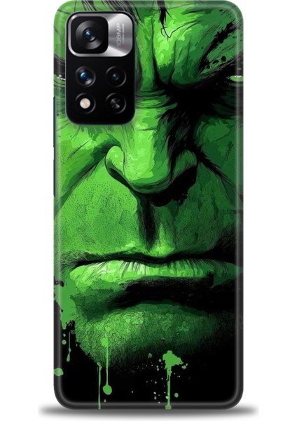Xiaomi Redmi Note 11 Pro Plus Hd Baskılı Kılıf + Seramik Tam Kaplayan Ekran Koruyucu 94