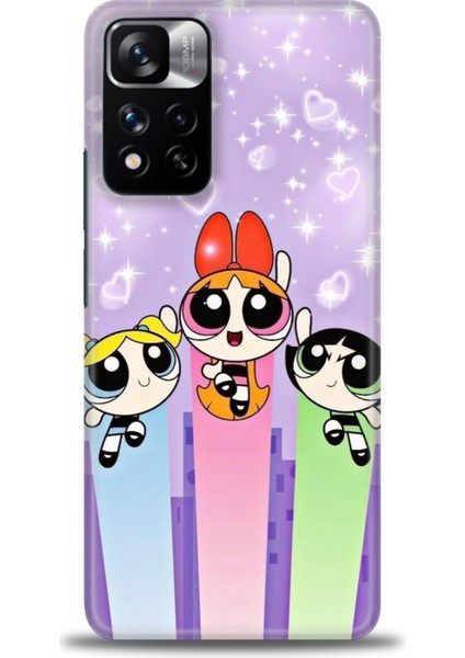 Xiaomi Redmi Note 11 Pro Plus Hd Baskılı Kılıf + Seramik Tam Kaplayan Ekran Koruyucu 128