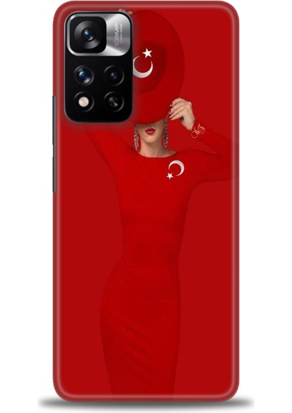 Xiaomi Redmi Note 11 Pro Plus Hd Baskılı Kılıf + Seramik Tam Kaplayan Ekran Koruyucu 241