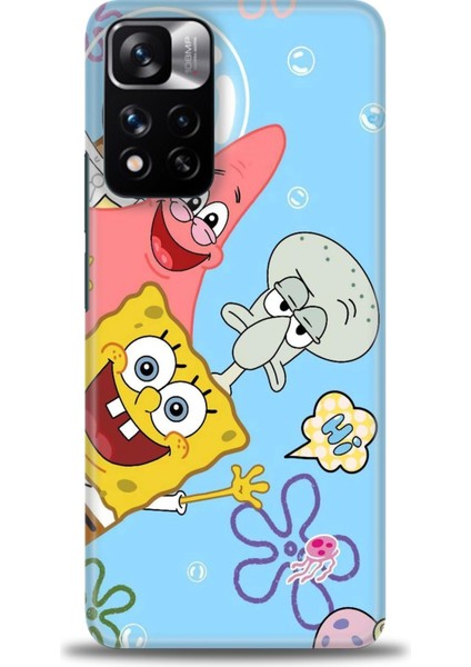 Xiaomi Redmi Note 11 Pro Plus Hd Baskılı Kılıf + Seramik Tam Kaplayan Ekran Koruyucu 452