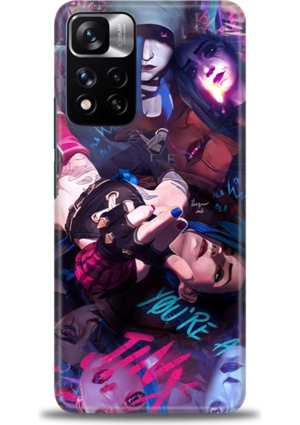 Xiaomi Redmi Note 11 Pro Plus Hd Baskılı Kılıf + Seramik Tam Kaplayan Ekran Koruyucu 278