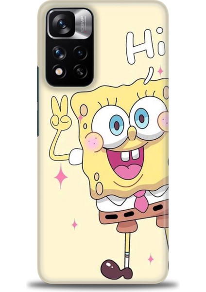 Xiaomi Redmi Note 11 Pro Plus Hd Baskılı Kılıf + Seramik Tam Kaplayan Ekran Koruyucu 457