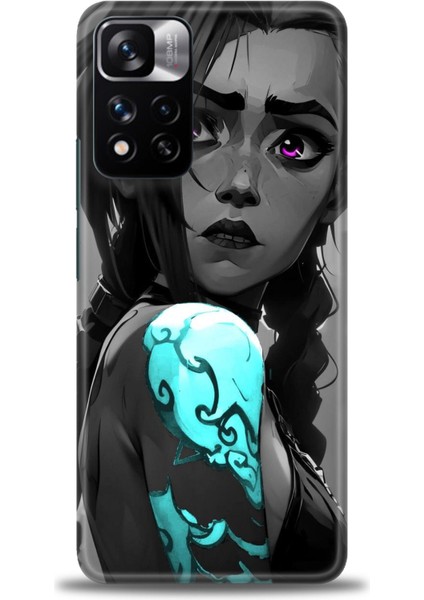 Xiaomi Redmi Note 11 Pro Plus Hd Baskılı Kılıf + Seramik Tam Kaplayan Ekran Koruyucu 279