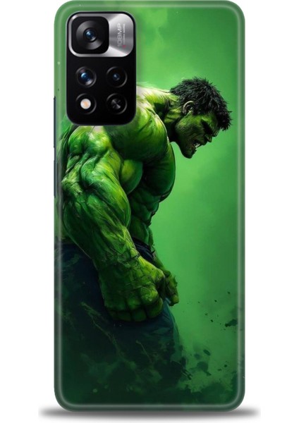 Xiaomi Redmi Note 11 Pro Plus Hd Baskılı Kılıf + Seramik Tam Kaplayan Ekran Koruyucu 96