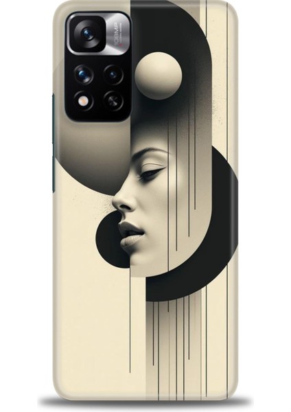 Xiaomi Redmi Note 11 Pro Plus Hd Baskılı Kılıf + Seramik Tam Kaplayan Ekran Koruyucu 149