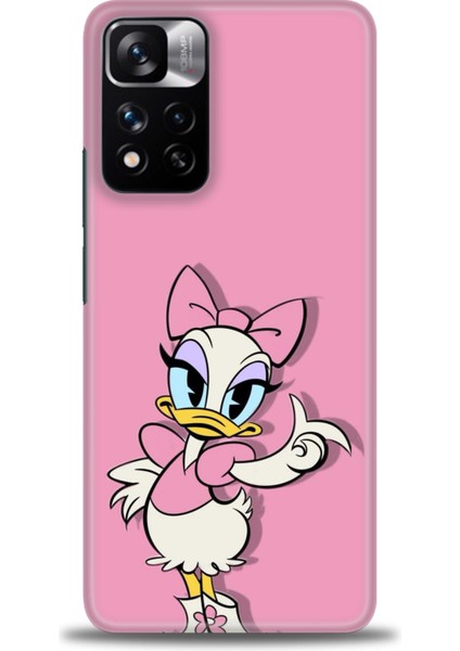 Xiaomi Redmi Note 11 Pro Plus Hd Baskılı Kılıf + Seramik Tam Kaplayan Ekran Koruyucu 406