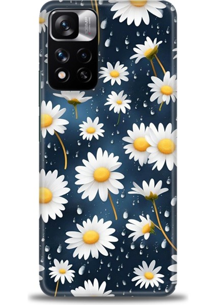 Xiaomi Redmi Note 11 Pro Plus Hd Baskılı Kılıf + Seramik Tam Kaplayan Ekran Koruyucu 132