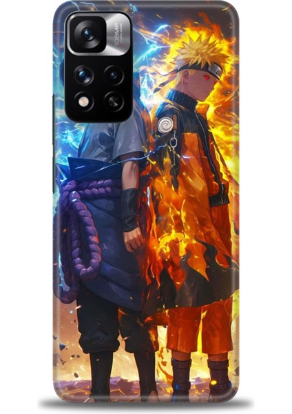 Xiaomi Redmi Note 11 Pro Plus Hd Baskılı Kılıf + Seramik Tam Kaplayan Ekran Koruyucu 260