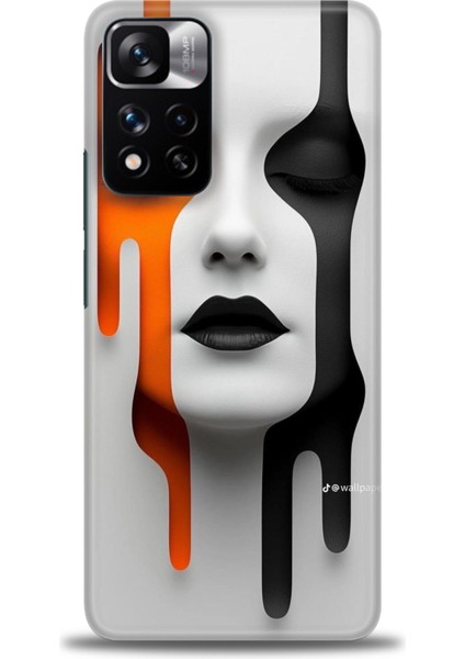 Xiaomi Redmi Note 11 Pro Plus Hd Baskılı Kılıf + Seramik Tam Kaplayan Ekran Koruyucu 143