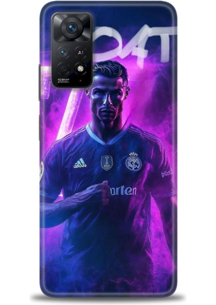 Xiaomi Redmi Note 11 Pro 4g Hd Baskılı Kılıf + Seramik Tam Kaplayan Ekran Koruyucu 9