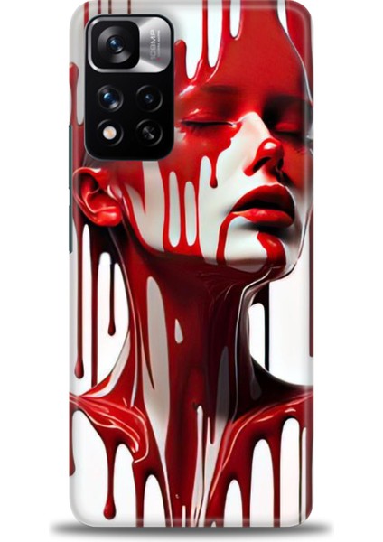 Xiaomi Redmi Note 11 Pro Plus Hd Baskılı Kılıf + Seramik Tam Kaplayan Ekran Koruyucu 150
