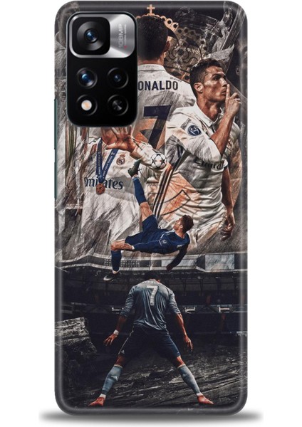 Xiaomi Redmi Note 11 Pro Plus Hd Baskılı Kılıf + Seramik Tam Kaplayan Ekran Koruyucu 10