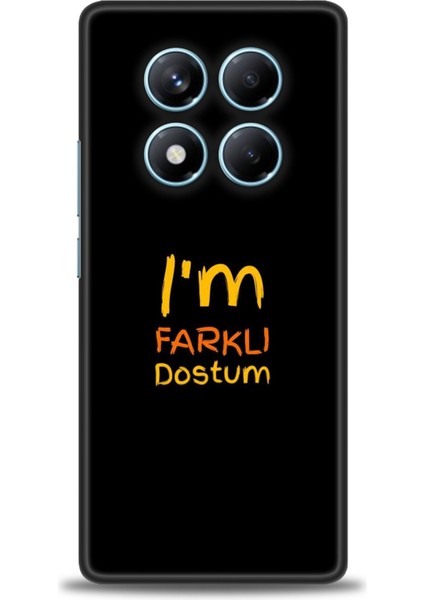 Xiaomi Redmi Note 14 Pro 4g Hd Baskılı Kılıf + Seramik Tam Kaplayan Ekran Koruyucu 399