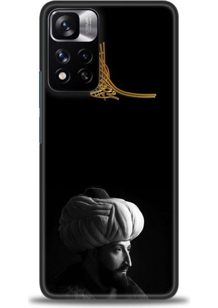 Xiaomi Redmi Note 11 Pro Plus Hd Baskılı Kılıf + Seramik Tam Kaplayan Ekran Koruyucu 465
