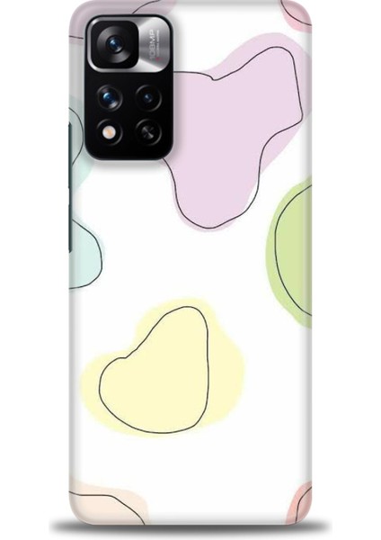 Xiaomi Redmi Note 11 Pro Plus Hd Baskılı Kılıf + Seramik Tam Kaplayan Ekran Koruyucu 174