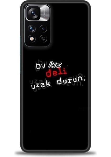 Xiaomi Redmi Note 11 Pro Plus Hd Baskılı Kılıf + Seramik Tam Kaplayan Ekran Koruyucu 398