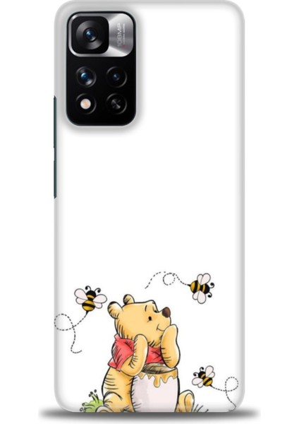 Xiaomi Redmi Note 11 Pro Plus Hd Baskılı Kılıf + Seramik Tam Kaplayan Ekran Koruyucu 57