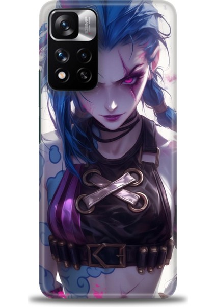 Xiaomi Redmi Note 11 Pro Plus Hd Baskılı Kılıf + Seramik Tam Kaplayan Ekran Koruyucu 276