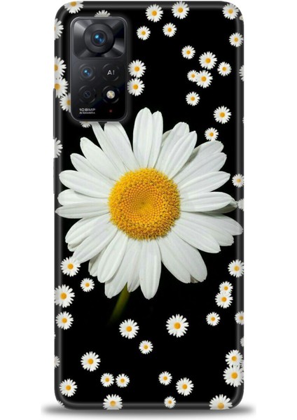 Xiaomi Redmi Note 11 Pro 4g Hd Baskılı Kılıf + Seramik Tam Kaplayan Ekran Koruyucu 134