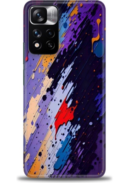 Xiaomi Redmi Note 11 Pro Plus Hd Baskılı Kılıf + Seramik Tam Kaplayan Ekran Koruyucu 436