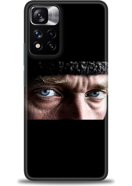 Xiaomi Redmi Note 11 Pro Plus Hd Baskılı Kılıf + Seramik Tam Kaplayan Ekran Koruyucu 28