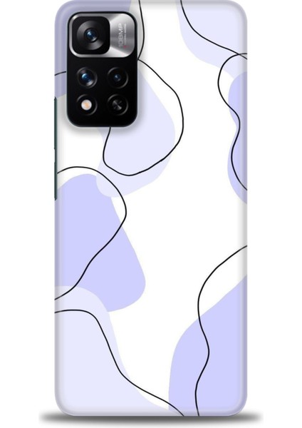 Xiaomi Redmi Note 11 Pro Plus Hd Baskılı Kılıf + Seramik Tam Kaplayan Ekran Koruyucu 178