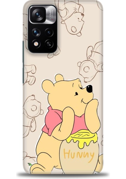 Xiaomi Redmi Note 11 Pro Plus Hd Baskılı Kılıf + Seramik Tam Kaplayan Ekran Koruyucu 58