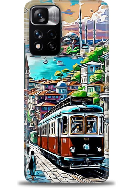 Xiaomi Redmi Note 11 Pro Plus Hd Baskılı Kılıf + Seramik Tam Kaplayan Ekran Koruyucu 225
