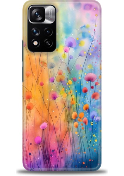 Xiaomi Redmi Note 11 Pro Plus Hd Baskılı Kılıf + Seramik Tam Kaplayan Ekran Koruyucu 413