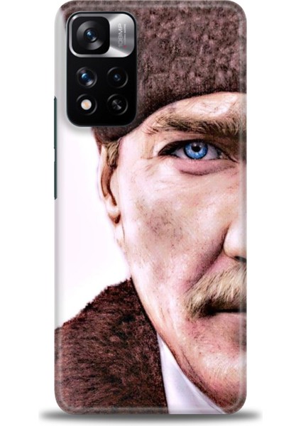 Xiaomi Redmi Note 11 Pro Plus Hd Baskılı Kılıf + Seramik Tam Kaplayan Ekran Koruyucu 29