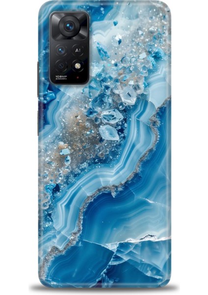 Xiaomi Redmi Note 11 Pro 4g Hd Baskılı Kılıf + Seramik Tam Kaplayan Ekran Koruyucu 317