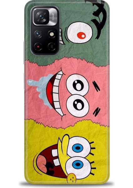 Xiaomi Redmi Note 11S Hd Baskılı Kılıf + Seramik Tam Kaplayan Ekran Koruyucu 460