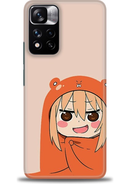 Xiaomi Redmi Note 11 Pro Plus Hd Baskılı Kılıf + Seramik Tam Kaplayan Ekran Koruyucu 499