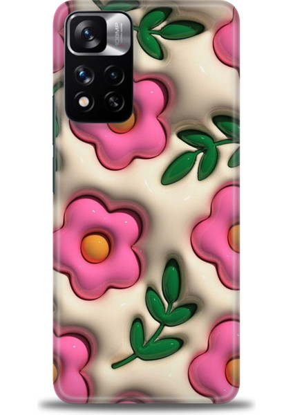 Xiaomi Redmi Note 11 Pro Plus Hd Baskılı Kılıf + Seramik Tam Kaplayan Ekran Koruyucu 111