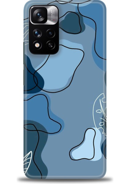 Xiaomi Redmi Note 11 Pro Plus Hd Baskılı Kılıf + Seramik Tam Kaplayan Ekran Koruyucu 172