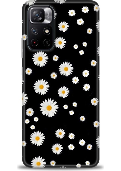 Xiaomi Redmi Note 11S Hd Baskılı Kılıf + Seramik Tam Kaplayan Ekran Koruyucu 131